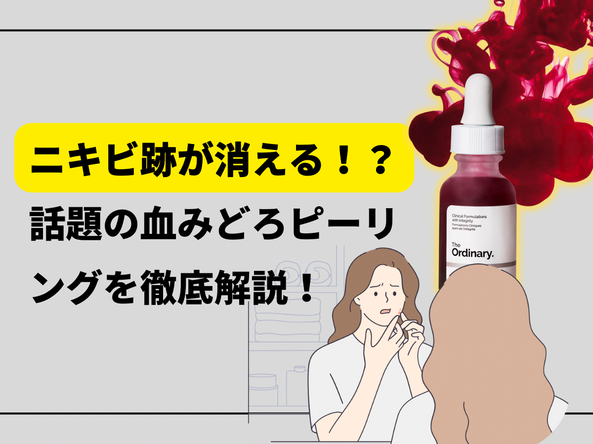 ニキビ跡が消える！？話題の血みどろピーリングを徹底解説！
